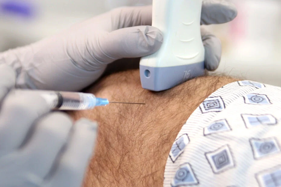 Trigger point therapy treatment on shoulder